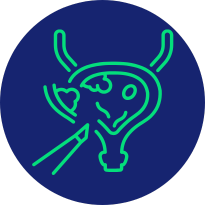 Cirugía reconstructiva urológica