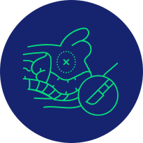 Prostatectomía robótica (por cáncer de próstata)